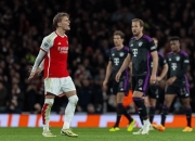 3377- 足总杯半决赛今晚开战视频 